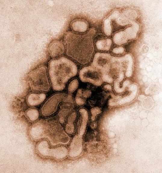 h1n1 vírus